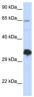 WB Suggested Anti-ZNF630 Antibody Titration: 0.2-1 ug/ml; ELISA Titer: 1: 312500; Positive Control: 293T cell lysate