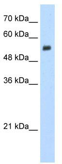 WB Suggested Anti-EVX2 Antibody Titration: 1.25 ug/ml; Positive Control: Jurkat cell lysate