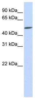 WB Suggested Anti-EVX2 Antibody Titration: 0.2-1 ug/ml; ELISA Titer: 1: 1562500; Positive Control: Human brain