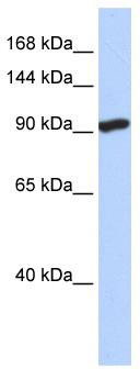 WB Suggested Anti-SIDT2 Antibody Titration: 0.2-1 ug/ml; ELISA Titer: 1: 1562500; Positive Control: Hela cell lysate
