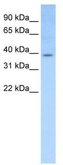 WB Suggested Anti-Elf3 Antibody Titration: 0.2-1 ug/ml; Positive Control: Mouse Trachea