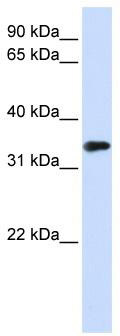 WB Suggested Anti-MBD3 Antibody Titration: 0.2-1 ug/ml; ELISA Titer: 1: 312500; Positive Control: Transfected 293T
