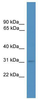 WB Suggested Anti-Mbd3 Antibody Titration: 0.2-1 ug/ml; ELISA Titer: 1: 1562500; Positive Control: Mouse Heart