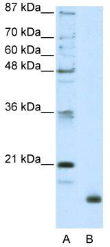 WB Suggested Anti-RPL32 Antibody Titration: 2.5 ug/ml; ELISA Titer: 1: 312500; Positive Control: HepG2 cell lysate