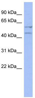 WB Suggested Anti-DAZ4 Antibody Titration: 0.2-1 ug/ml; ELISA Titer: 1: 62500; Positive Control: HT1080 cell lysate