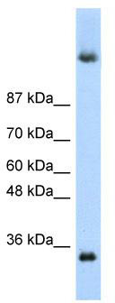 WB Suggested Anti-DAZ4 Antibody Titration: 0.2-1 ug/ml; ELISA Titer: 1: 312500; Positive Control: HepG2 cell lysate