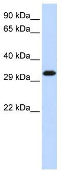 WB Suggested Anti-SIP1 Antibody Titration: 0.2-1 ug/ml; ELISA Titer: 1: 312500; Positive Control: Hela cell lysate.GEMIN2 is strongly supported by BioGPS gene expression data to be expressed in HeLa