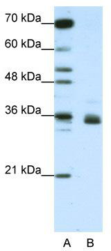 WB Suggested Anti-RP11-78J21.1 Antibody Titration: 1.25 ug/ml; ELISA Titer: 1: 312500; Positive Control: Jurkat cell lysate.HNRNPA1L2 is strongly supported by BioGPS gene expression data to be expressed in Human Jurkat cells