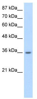 WB Suggested Anti-RP11-78J21.1 Antibody Titration: 0.2-1 ug/ml; Positive Control: Jurkat cell lysate.HNRNPA1L2 is strongly supported by BioGPS gene expression data to be expressed in Human Jurkat cells
