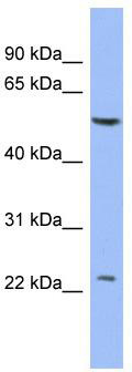 WB Suggested Anti-PABPC1L2A Antibody Titration: 0.2-1 ug/ml; ELISA Titer: 1: 62500; Positive Control: THP-1 cell lysate