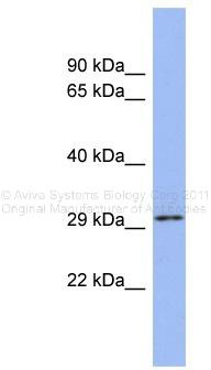 Western blot analysis of extracts of various cell lines, using CTCF antibody (TA375184) at 1:500 dilution.|Secondary antibody: HRP Goat Anti-Rabbit IgG (H+L) at 1:10000 dilution.|Lysates/proteins: 25ug per lane.|Blocking buffer: 3% nonfat dry milk in TBST.|Detection: ECL Basic Kit .|Exposure time: 1s.