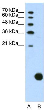 Western blot analysis of extracts from normal (control) and CTCF knockout (KO) 293T cells, using CTCF antibody (TA375186) at 1:1000 dilution.|Secondary antibody: HRP Goat Anti-Rabbit IgG (H+L) at 1:10000 dilution.|Lysates/proteins: 25ug per lane.|Blocking buffer: 3% nonfat dry milk in TBST.|Detection: ECL Basic Kit .|Exposure time: 10s.