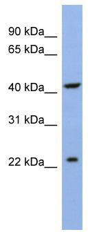WB Suggested Anti-SLC35F1 Antibody Titration: 0.2-1 ug/ml; ELISA Titer: 1: 312500; Positive Control: OVCAR-3 cell lysate