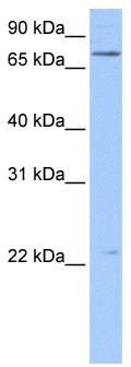 WB Suggested Anti-BFSP1 Antibody Titration: 0.2-1 ug/ml; Positive Control: Hela cell lysate
