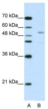 WB Suggested Anti-GRSF1 Antibody Titration: 2.5 ug/ml; ELISA Titer: 1: 62500; Positive Control: HepG2 cell lysate