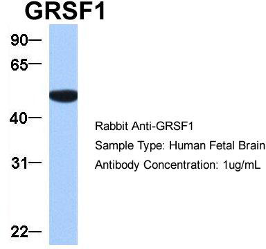 Host: Rabbit; Target Name: GRSF1; Sample Tissue: Hela; Antibody Dilution: 1.0 ug/ml