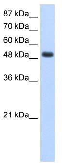 WB Suggested Anti-RBMS1 Antibody Titration: 1.25 ug/ml; Positive Control: HepG2 cell lysate; RBMS1 is strongly supported by BioGPS gene expression data to be expressed in Human HepG2 cells