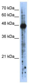 WB Suggested Anti-RBMS2 Antibody Titration: 0.2-1 ug/ml; ELISA Titer: 1: 62500; Positive Control: Transfected 293T