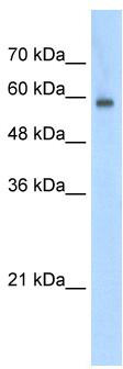 WB Suggested Anti-EIF4G3 Antibody Titration: 0.2-1 ug/ml; Positive Control: Jurkat cell lysate