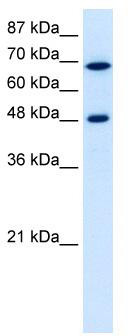 WB Suggested Anti-RRP9 Antibody Titration: 5.0 ug/ml; Positive Control: Jurkat cell lysate; RRP9 is supported by BioGPS gene expression data to be expressed in Jurkat