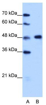 WB Suggested Anti-HNRPF Antibody Titration: 1.25 ug/ml; Positive Control: HepG2 cell lysateHNRNPF is supported by BioGPS gene expression data to be expressed in HepG2
