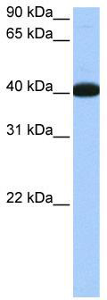 WB Suggested Anti-NOL5A Antibody Titration: 0.2-1 ug/ml; Positive Control: Human lung