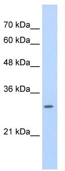 WB Suggested Anti-SLBP Antibody Titration: 0.2-1 ug/ml; ELISA Titer: 1: 312500; Positive Control: HepG2 cell lysate; SLBP is supported by BioGPS gene expression data to be expressed in HepG2