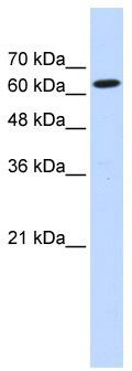 Western blot analysis of extracts of various cell lines, using DENR antibody (TA375418) at 1:3000 dilution.|Secondary antibody: HRP Goat Anti-Rabbit IgG (H+L) at 1:10000 dilution.|Lysates/proteins: 25ug per lane.|Blocking buffer: 3% nonfat dry milk in TBST.|Detection: ECL Enhanced Kit .|Exposure time: 90s.