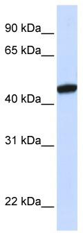 WB Suggested Anti-KRR1 Antibody Titration: 0.2-1 ug/ml; ELISA Titer: 1: 62500; Positive Control: Human brain