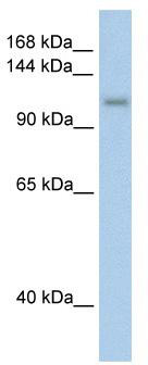 WB Suggested Anti-PRPF6 Antibody Titration: 2.5 ug/ml; ELISA Titer: 1: 62500; Positive Control: Transfected 293T