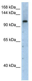 WB Suggested Anti-PRPF6 Antibody Titration: 2.5 ug/ml; Positive Control: Transfected 293T