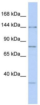 WB Suggested Anti-RNASEN Antibody Titration: 0.2-1 ug/ml; ELISA Titer: 1: 62500; Positive Control: Human Spleen
