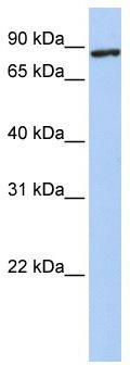 WB Suggested Anti-TMEM63A Antibody Titration: 0.2-1 ug/ml; Positive Control: 293T cell lysate