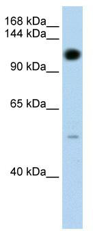 WB Suggested Anti-PUM2 Antibody Titration: 1.25 ug/ml; ELISA Titer: 1: 62500; Positive Control: Transfected 293T