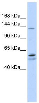 WB Suggested Anti-PUM2 Antibody Titration: 0.2-1 ug/ml; ELISA Titer: 1: 312500; Positive Control: Human Liver