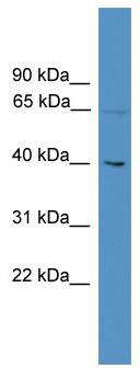 WB Suggested Anti-UTP18 Antibody Titration: 0.2-1 ug/ml; ELISA Titer: 1: 62500; Positive Control: Jurkat cell lysate; UTP18 is supported by BioGPS gene expression data to be expressed in Jurkat