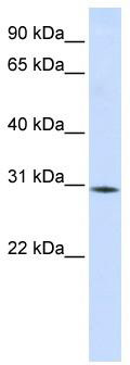 WB Suggested Anti-RBM7 Antibody Titration: 0.2-1 ug/ml; ELISA Titer: 1: 312500; Positive Control: Human Liver