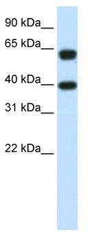 WB Suggested Anti-NXF3 Antibody Titration: 1.25 ug/ml; Positive Control: RPMI 8226 cell lysateNXF3 is supported by BioGPS gene expression data to be expressed in RPMI 8226
