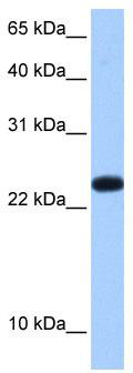 WB Suggested Anti-C19orf24 Antibody Titration: 0.2-1 ug/ml; Positive Control: Human Placenta