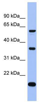 WB Suggested Anti-LARP6 Antibody Titration: 0.2-1 ug/ml; ELISA Titer: 1: 1562500; Positive Control: ACHN cell lysate