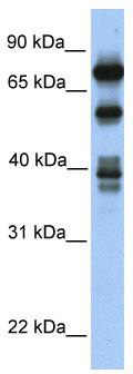 WB Suggested Anti-STRBP Antibody Titration: 0.2-1 ug/ml; Positive Control: Transfected 293T
