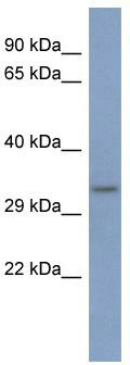 WB Suggested Anti-PCBP3 Antibody Titration: 0.2-1 ug/ml; ELISA Titer: 1: 312500; Positive Control: HT1080 cell lysate