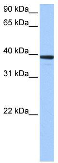 WB Suggested Anti-MRM1 Antibody Titration: 0.2-1 ug/ml; Positive Control: Human brain