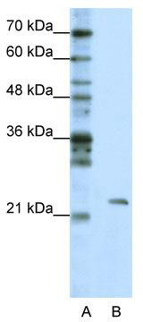 WB Suggested Anti-MRM1 Antibody Titration: 1.25 ug/ml; Positive Control: HepG2 cell lysate