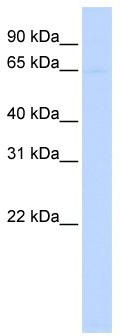 WB Suggested Anti-PIGZ Antibody Titration: 0.2-1 ug/ml; ELISA Titer: 1: 1562500; Positive Control: Hela cell lysate