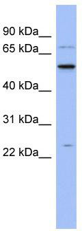 WB Suggested Anti-ZCRB1 Antibody Titration: 0.2-1 ug/ml; ELISA Titer: 1: 312500; Positive Control: Human Spleen