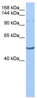 WB Suggested Anti-LARP1 Antibody Titration: 0.2-1 ug/ml; Positive Control: 721_B cell lysateLARP1 is strongly supported by BioGPS gene expression data to be expressed in Human 721_B cells