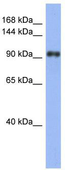 WB Suggested Anti-LARP1 Antibody Titration: 0.2-1 ug/ml; ELISA Titer: 1: 312500; Positive Control: Human Stomach
