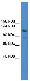 WB Suggested Anti-LARP1 Antibody Titration: 0.2-1 ug/ml; ELISA Titer: 1: 62500; Positive Control: Jurkat cell lysateThere is BioGPS gene expression data showing that LARP1 is expressed in Jurkat