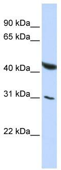 WB Suggested Anti-BRUNOL6 Antibody Titration: 0.2-1 ug/ml; ELISA Titer: 1: 62500; Positive Control: HepG2 cell lysate